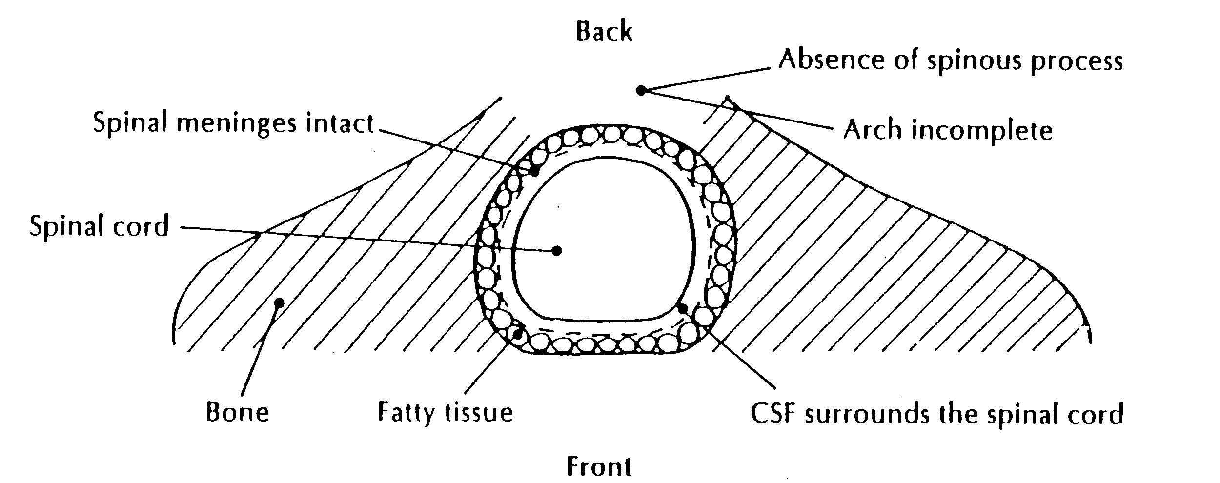 Occulta spine.gif (39377 bytes)